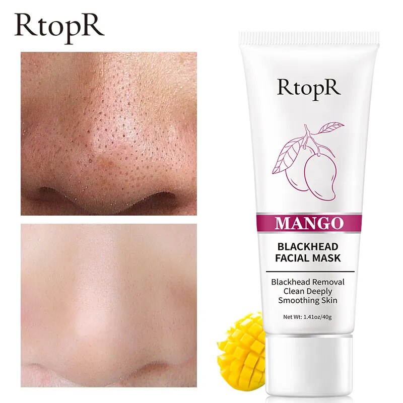 RtopR Mango Blackhead Remover Nose Pack Facial Cleansing treatment
