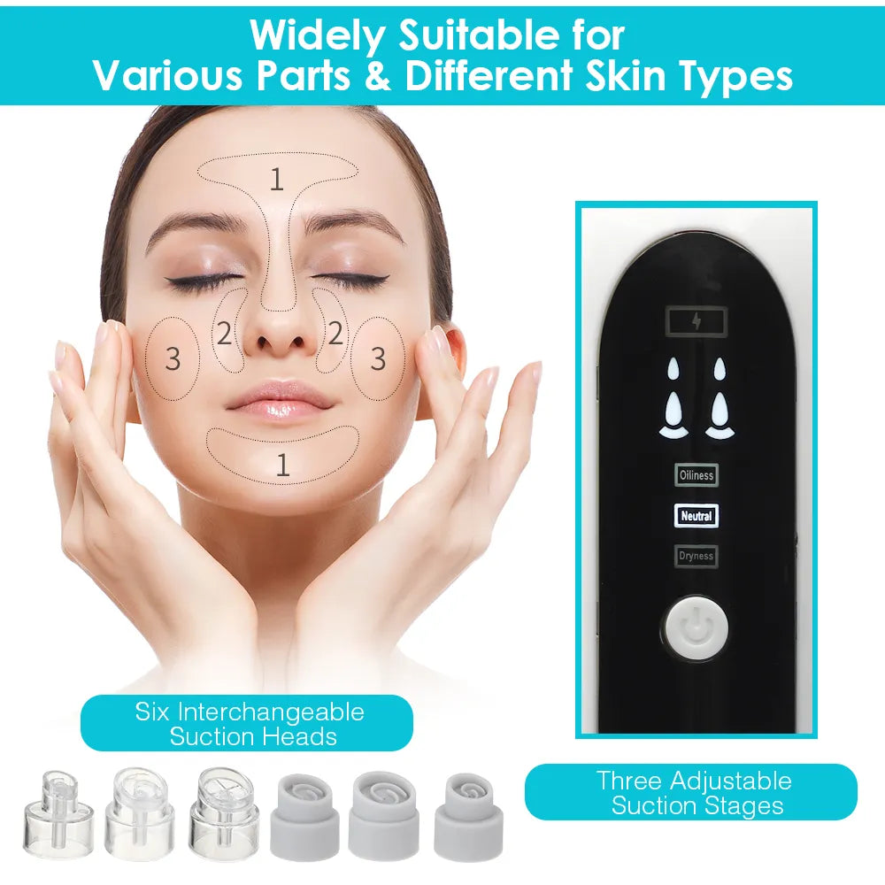 Blackhead Remover Pore Cleaner Vacuum Suction Acne Remover skin care