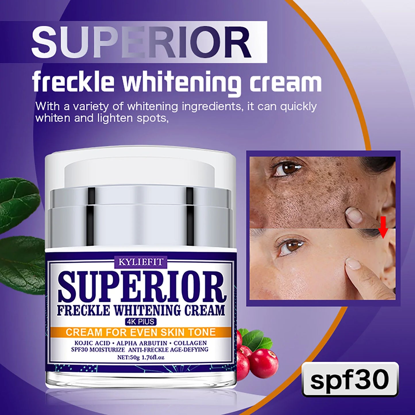 Dark Spot Remover for Face, Whitening Cream for Women and Men