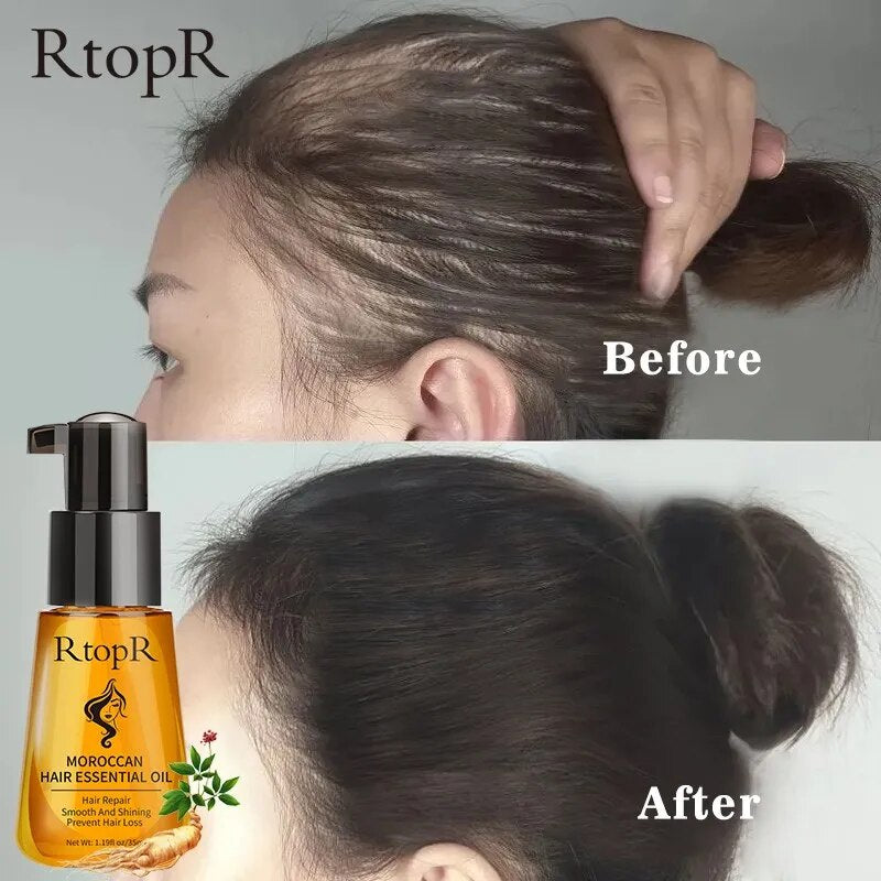 Prevent Hair Loss Essential Oil Beauty Health Damaged Growth Repair Product